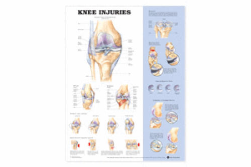 Knee Injuries Chart
