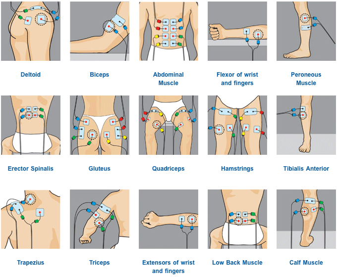 Electrode Placement