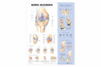 Knee Injuries Chart