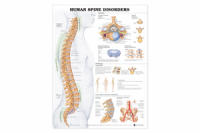 Human Spine Disorders Chart